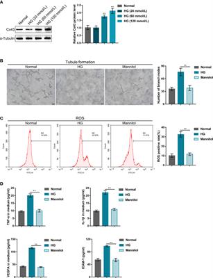 Connexin 43 (Cx43) regulates high-glucose-induced retinal endothelial cell angiogenesis and retinal neovascularization